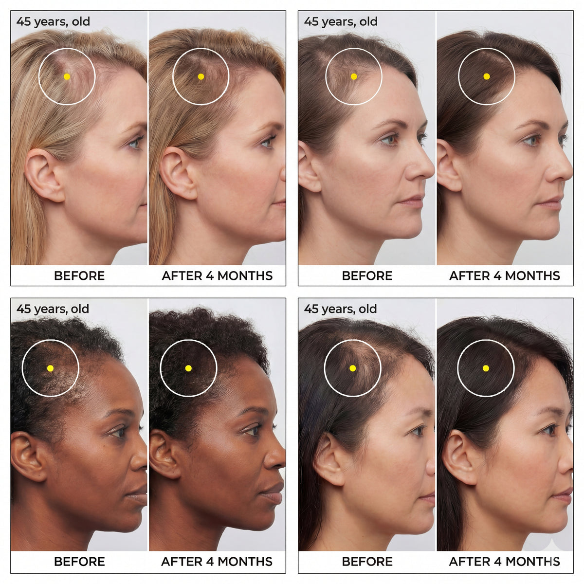 Hair Priority Complex