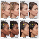 Hair Priority Complex - Offre Rosabella