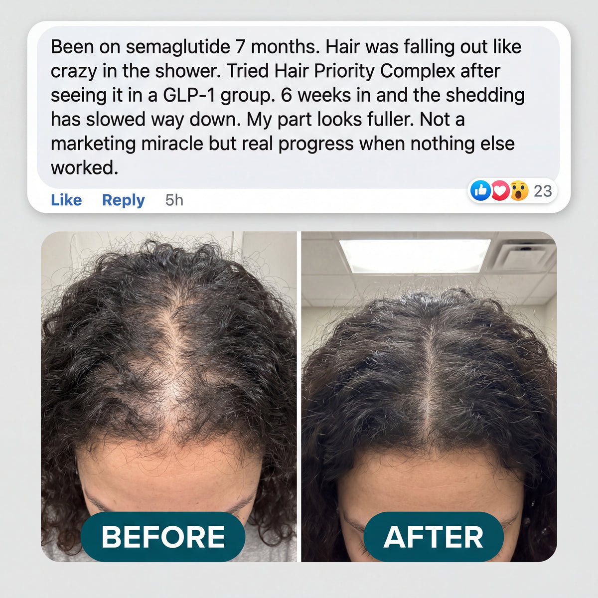 Hair Priority Complex