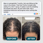 Hair Priority Complex