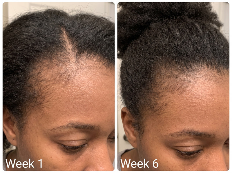Six weeks in, honest update