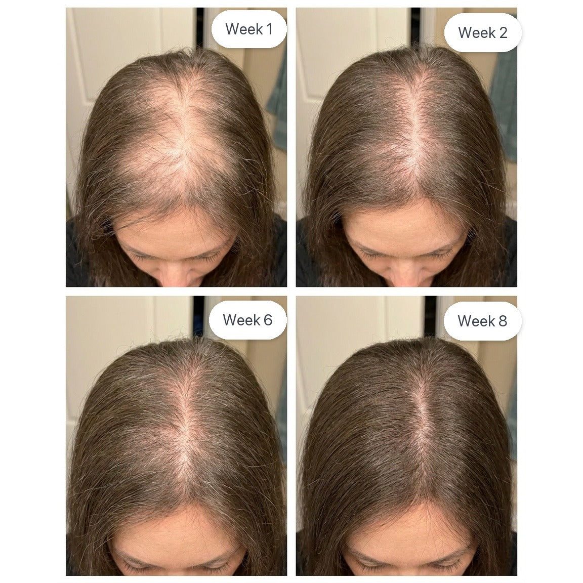 Hair regrowth progress — Week 1 to Week 8