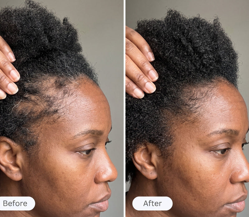 MY EDGES ARE COMING BACK